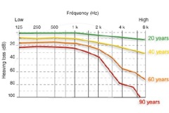 Pure tone audiograms recorded in a normally-hearing subject over the course of their life. Each curve represents the average hearing loss as a function of age