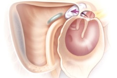 page54-1001-full