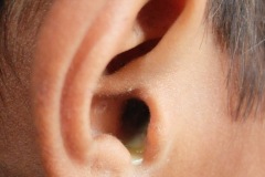 Bilateral discharge, TT CSOM, Right ear, boy