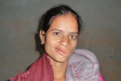Complete left facial palsy from CSOM