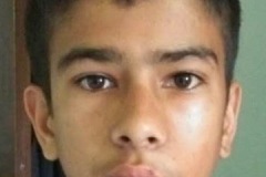 facial palsy, left ear, surgical complication, young boy, at rest.