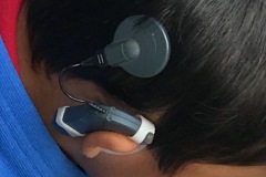 Cochlear implant, young boy.