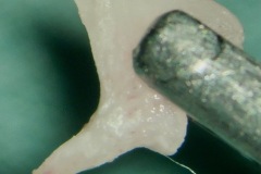 Incus, left side (note lenticular process)