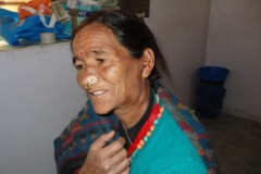 Parotid tumour post-op