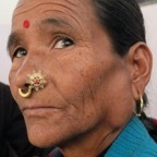 Parotid tumour,1